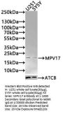 MPV17 Antibody