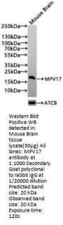 MPV17 Antibody