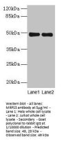 MRPS5 Antibody