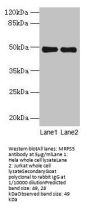MRPS5 Antibody