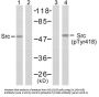 Phospho-SRC (Tyr418) Antibody
