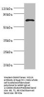 MSLN Antibody