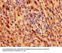 MTRF1 Antibody