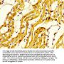 MYH7 Antibody