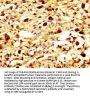 MYH7 Antibody