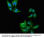 NAT1 Antibody