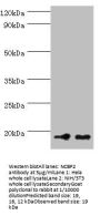 NCBP2 Antibody