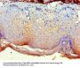NCK2 Antibody