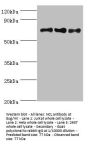 NCL Antibody