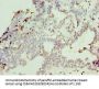 NCL Antibody