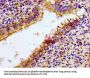 NCR3 Antibody