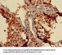 NDUFB3 Antibody