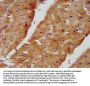 NDUFB8 Antibody