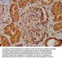 NDUFB8 Antibody
