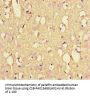 NEFL Antibody