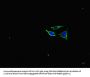 NEFL Antibody