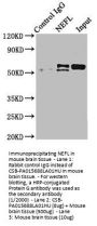 NEFL Antibody