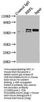 NEFL Antibody