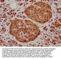 NEURL1B Antibody