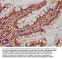 NEURL1B Antibody