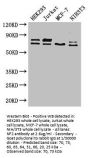 NF2 Antibody