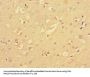 NF2 Antibody