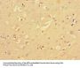 NF2 Antibody