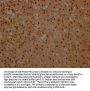 NFKBIA Antibody