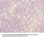 NFYB Antibody