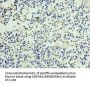 NOV Antibody