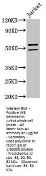 NOVA1 Antibody