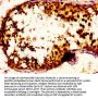 NOVA1 Antibody