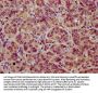 NOXO1 Antibody