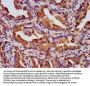 NPHP4 Antibody