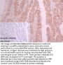 NPHS1 Antibody