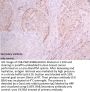 NPHS1 Antibody