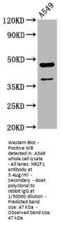 NR2F1 Antibody
