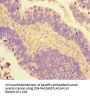 NR2F2 Antibody