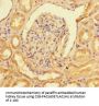 NR2F2 Antibody