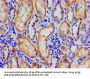 NR3C1 Antibody