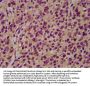 NRCAM Antibody