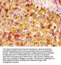 NTN1 Antibody