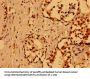 NUMA1 Antibody