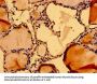 NUMA1 Antibody