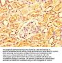 OCRL Antibody
