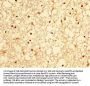 OCRL Antibody