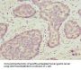 OPHN1 Antibody