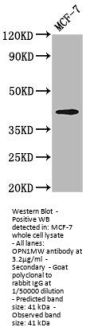 OPN1MW Antibody