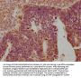 OPRK1 Antibody