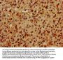 HIST1H2BC Antibody